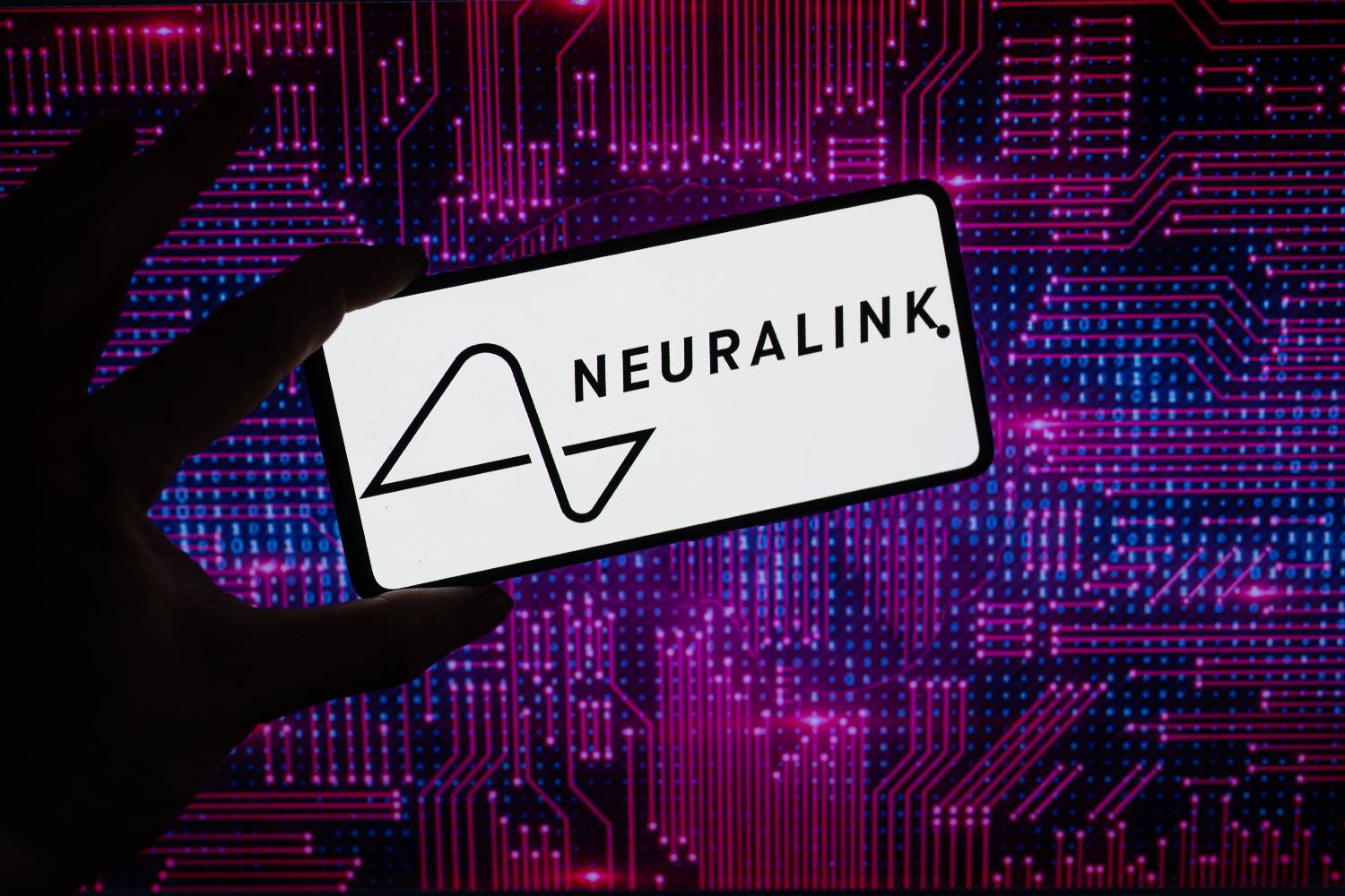 Neuralink prevê produção em escala de implantes cerebrais e cirurgias automatizadas a partir de 2026